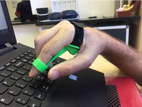 3d print occupational therapy toolkit for quadriplegic 2